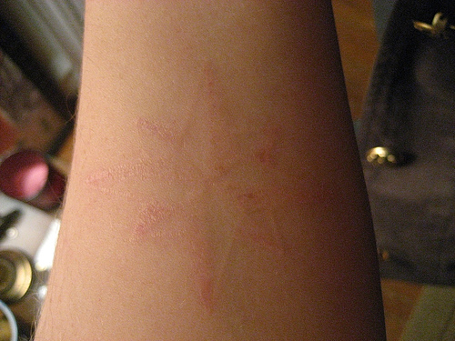 Star UV In Normal Light Tattoo On Arm