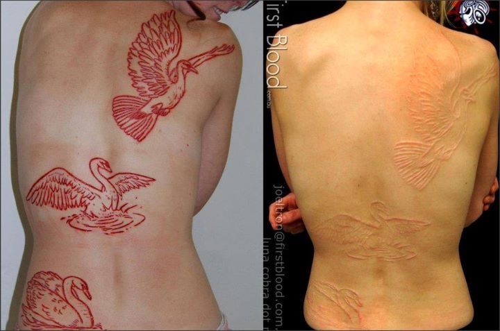 Swan Before And After Scarification Tattoo On Full Back
