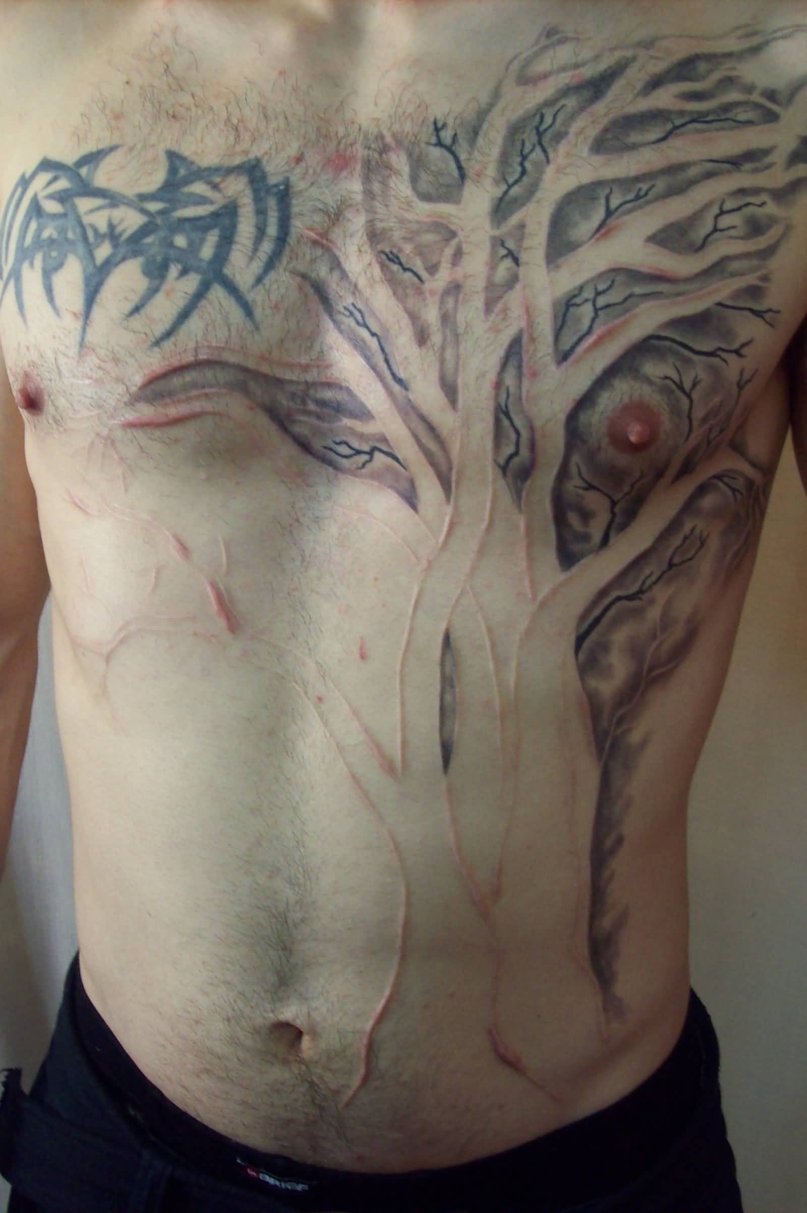 Tree Scarification In Progress Tattoo On Front Body For Men