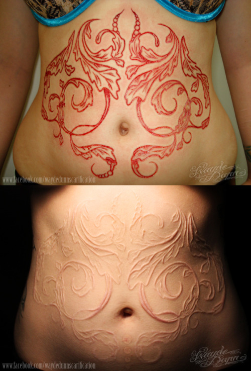 Victorian Filigree Before And After Scarification Stomach Tattoo