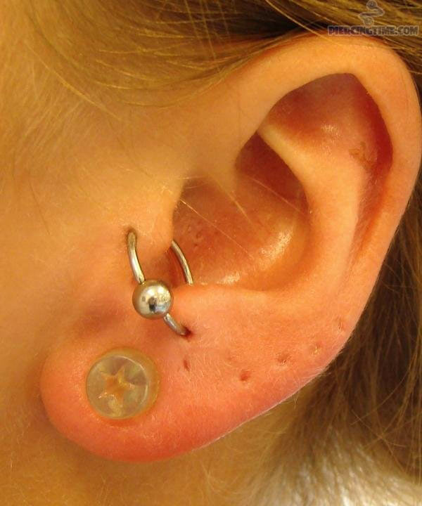 Anti Tragus To Tragus Piercing With Hoop Ring