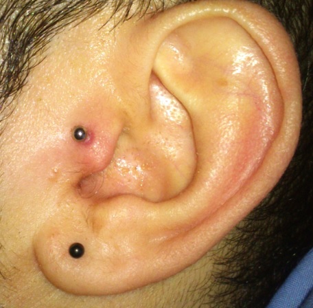 Lobe Piercing And Tragus Piercing On Left Ear