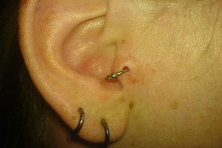 Round Rings Lobe And Tragus Piercing