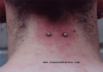 Back Neck Surface Piercing Picture