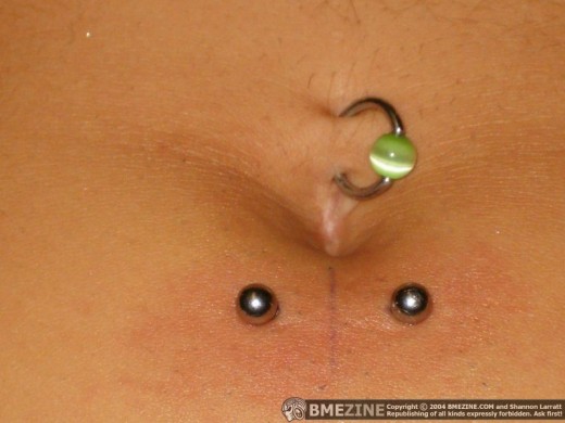 Belly Piercing And Surface Navel Piercing