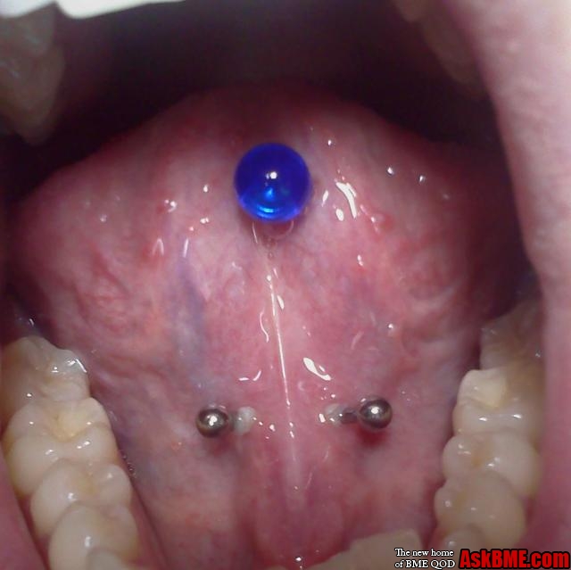 Blue Stud Tongue and Tongue Frenulum Piercing With Barbell