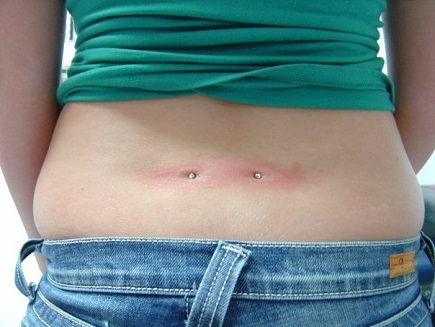 Dermal Anchors Lower Back Piercing Picture