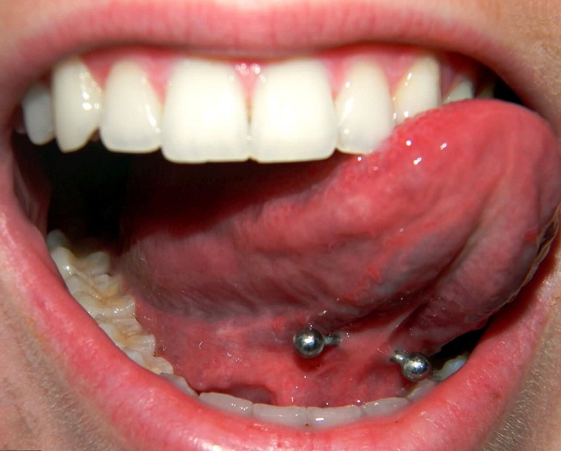 Silver Barbell Tongue Frenulum Picture For Girls