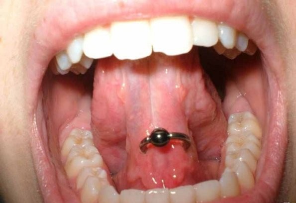 Silver Bead Ring Tongue Frenulum Piercing Picture