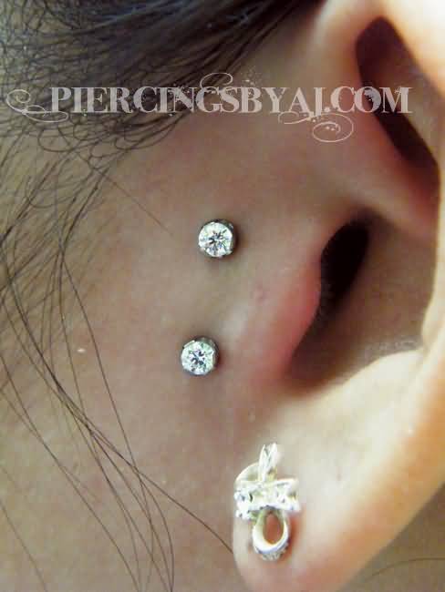 Surface Ear Piercing  With Dermal Anchors