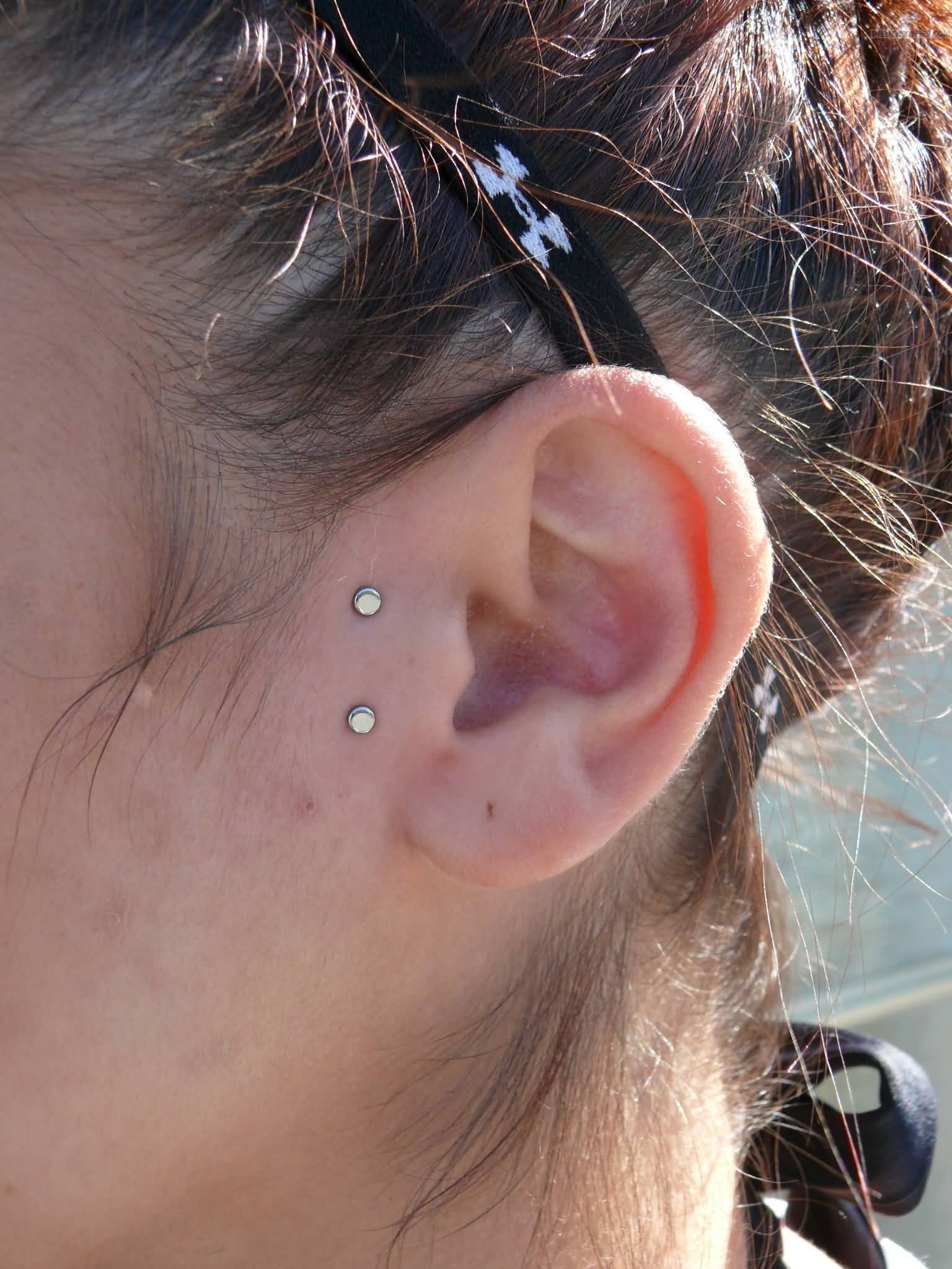 Surface Ear Piercing With Dermals