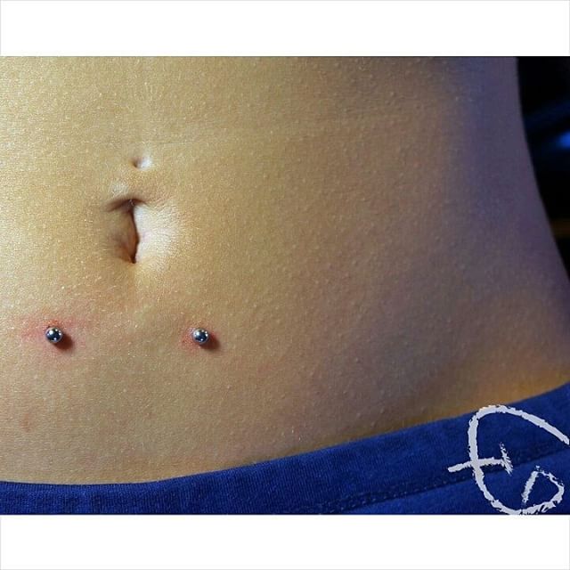 Surface Navel Piercing With Dermal Studs