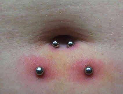 Surface Navel Piercing With Silver Barbells