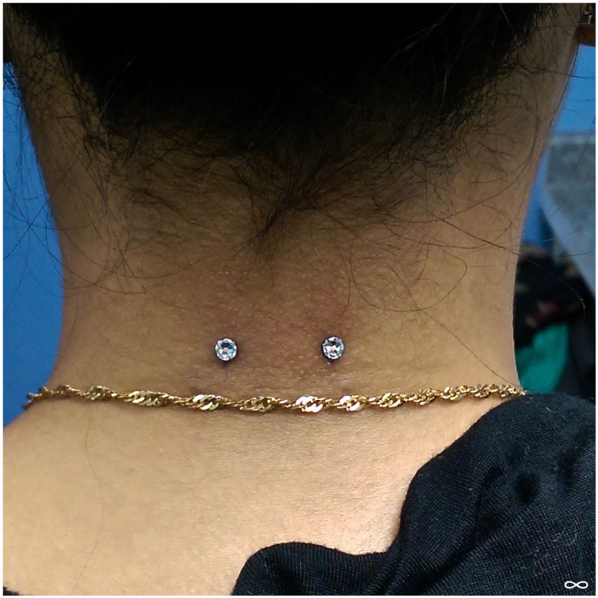 Surface Neck Piercing With Anchor Dermal