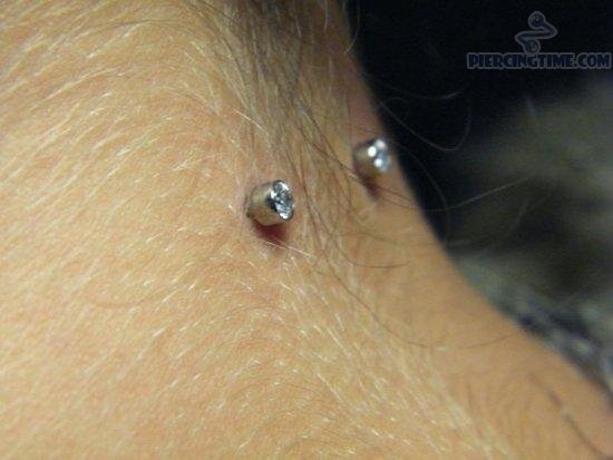 Surface Neck Piercing With Dermal Anchors