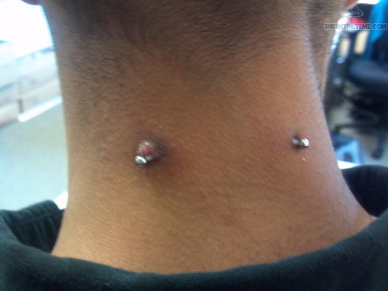 Surface Neck Piercing With Large Silver Barbell