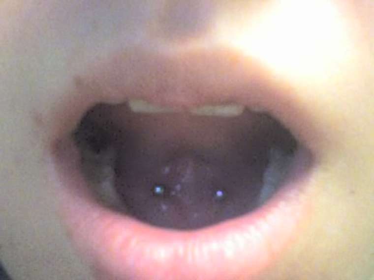 Tongue Frenulum Piercing With Barbell