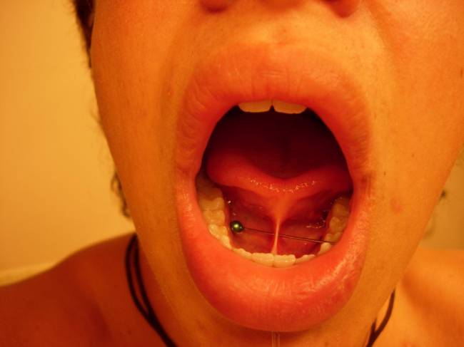 Tongue Frenulum Piercing With Green Barbell