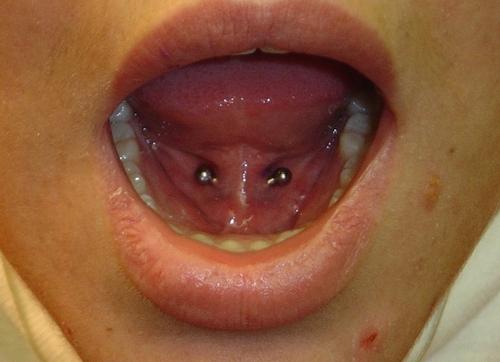 Tongue Frenulum Piercing With Silver Curved Barbell