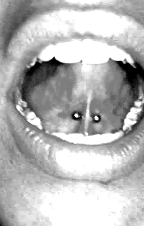 Tongue Frenulum Piercing With Small Barbell by Bubblexd