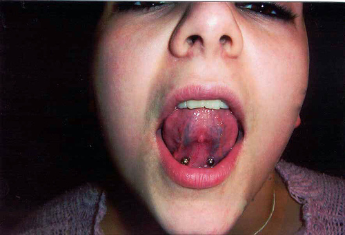 Woman Showing Tongue Frenulum Piercing