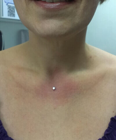 Single Microdermal Piercing On Chest