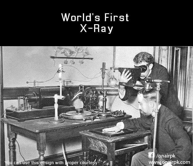 World's First X-Ray