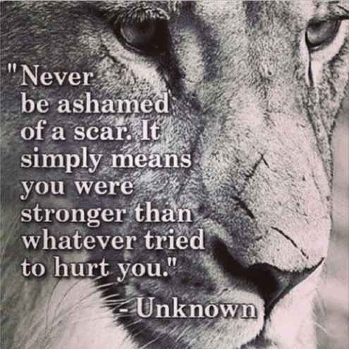 Never be ashamed of a scar. It simply means you were stronger than whatever tried to hurt you.