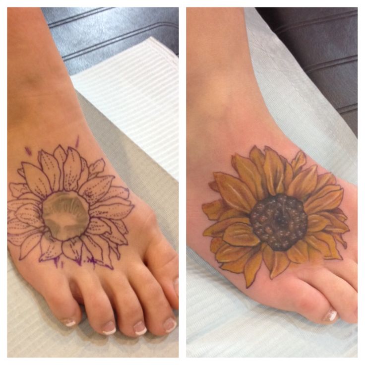 Sunflower Before And After Foot Tattoo
