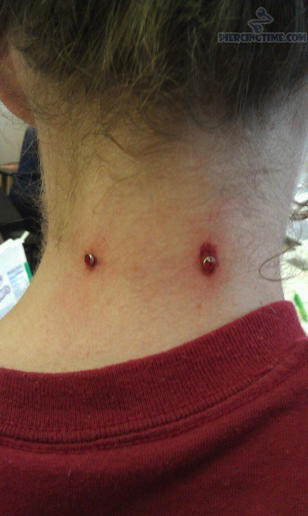 Back Neck Piercing With Red Dermal Anchors