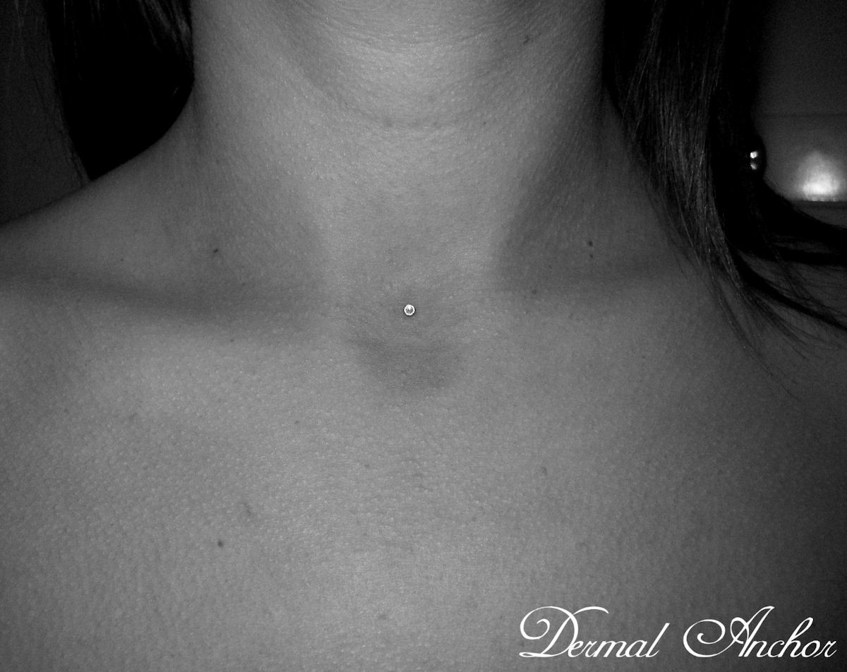 Front Neck Piercing With Single Dermal Anchor