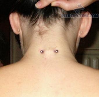 Girl Showing Her Surface Neck Piercing Picture