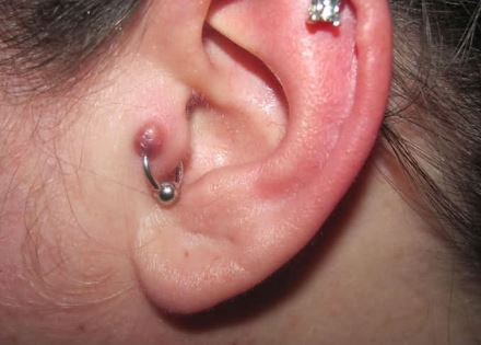 Recent Pierced Tragus Piercing With Silver Bead Ring