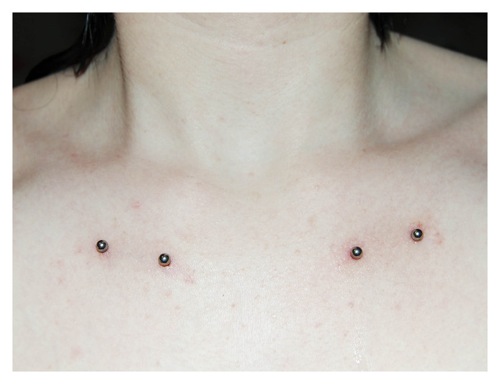 Silver Barbells Clavicle Piercing Picture