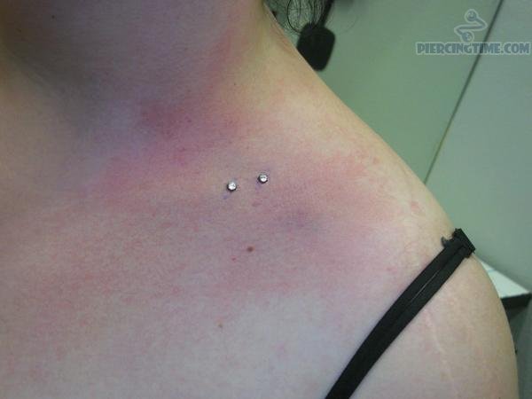 Sub Clavicle Surface Piercing With Dermals