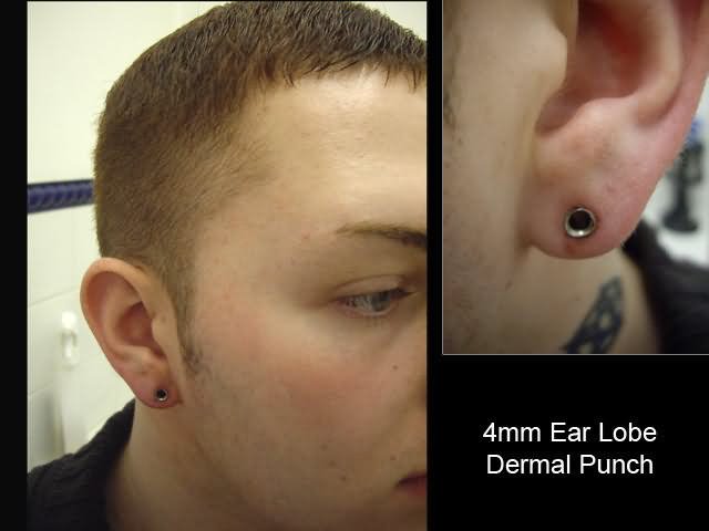 4mm Ear Lobe Dermal Punch Piercing