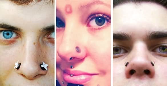 Dermal Punch Nose And Cartilage Piercings