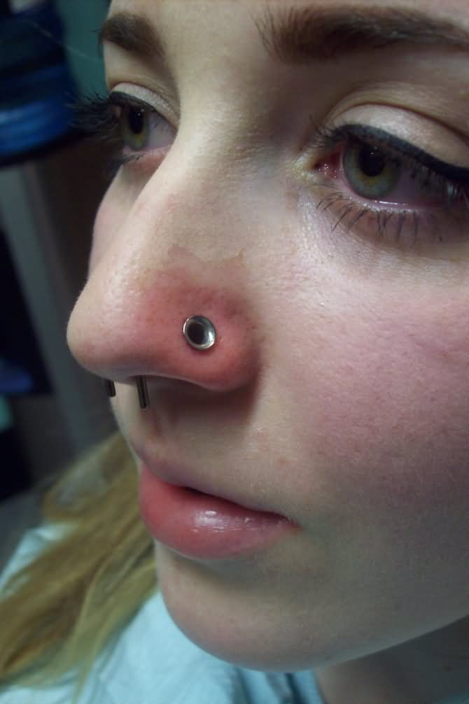 Dermal Punch Nose Piercing