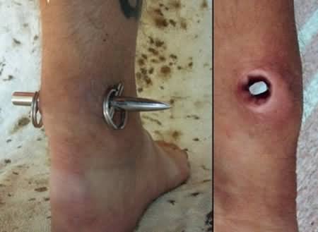 Extreme Ankle Body Piercing