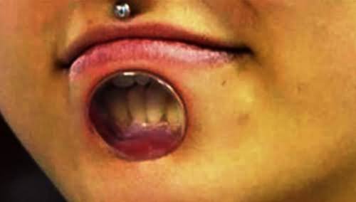 Extreme Lower Lip Body Piercing