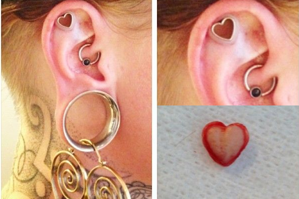Heart Cartilage And Dermal Punch Piercing