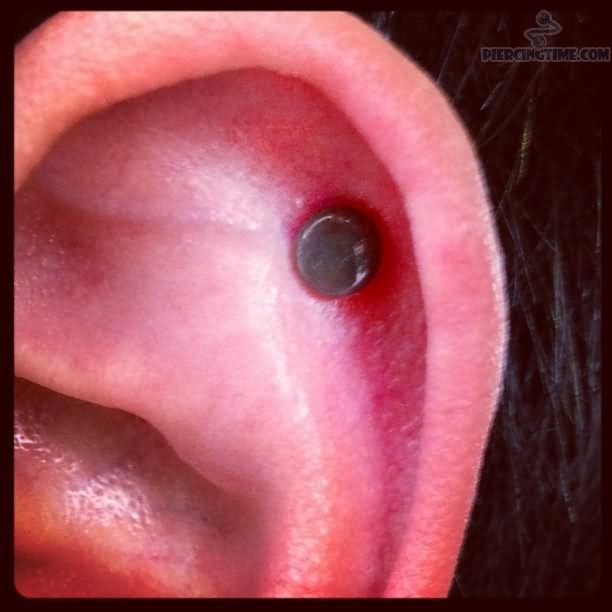 Left Ear Dermal Punch Piercing