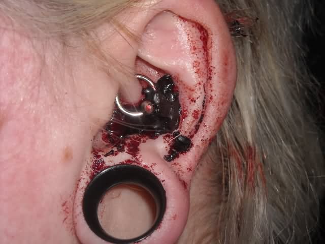 Left Ear Lobe And Dermal Punch Piercing