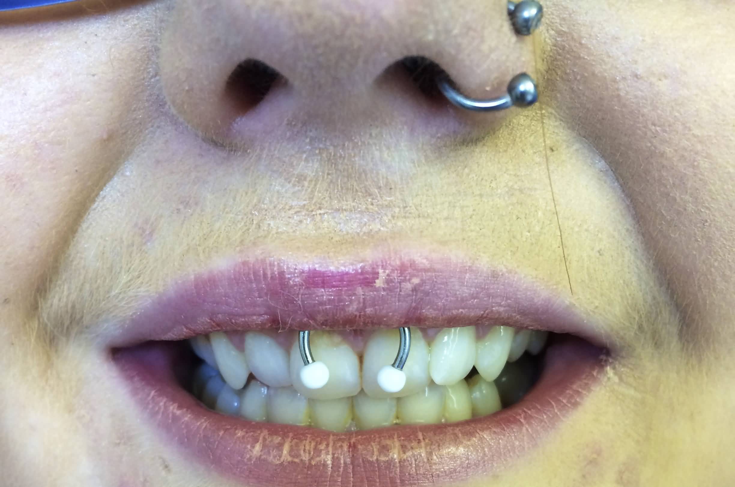 Nostril And Smiley Piercing For Girls