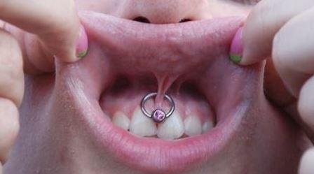 Pink Opal Ring Smiley Piercing