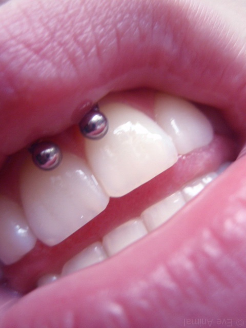 Smiley Piercing Closeup Image