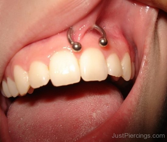 Smiley Piercing With Circular Barbell