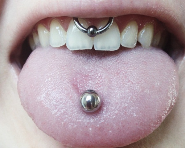 Tongue Piercing And Smiley Piercing