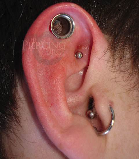 Tragus And Dermal Punch Piercing On Right Ear