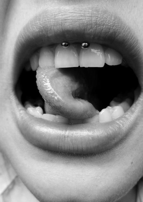 Upper Lip Smiley Piercing With Circular Barbell